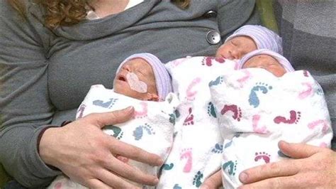 California Couple Conceives Rare Identical Triplets