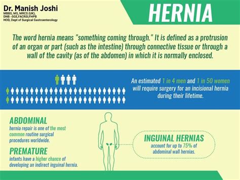 Hernia Is A Protrusion Of An Organ Through The Cavity Wall Here‘s All