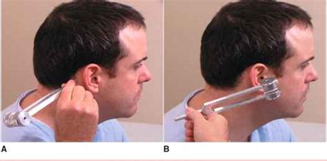 Ear Rinne Test Dr Meenesh Juveekar Ent Specialist