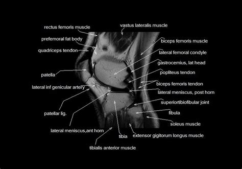 Knee Muscle Anatomy Axial Mri Magnetic Resonance Imaging Knee Injury