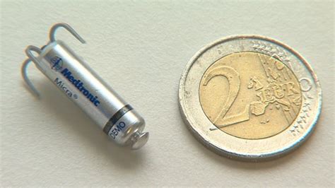 A New Bullet Sized Pacemaker Launched For Heart Patients And Its Fitted