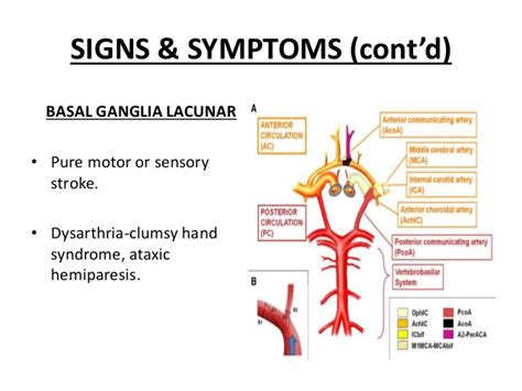 Amazing What Are The Symptoms Of A Lacunar Stroke Insectza