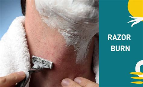 Razor Burn Causes Treatment And More Resurchify
