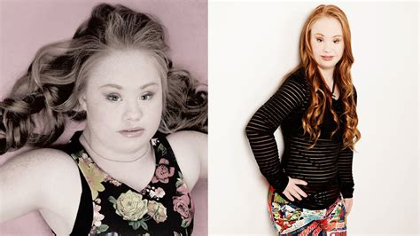 Photos Teen Hopes Modeling Career Shows Down Syndrome Can Be Sexy And Beautiful Abc11
