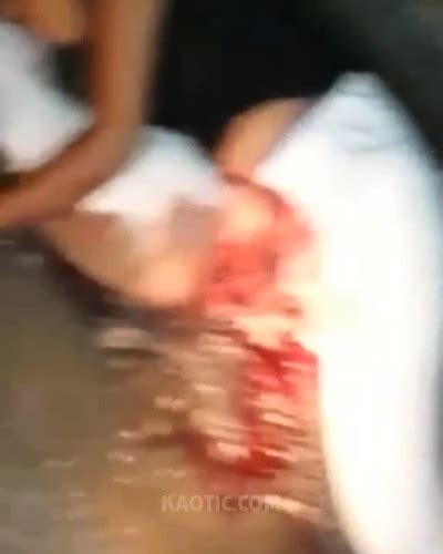 【閲覧注意】事故で女性器から内臓が飛び出てしまった女性が発見される（動画） ポッカキット