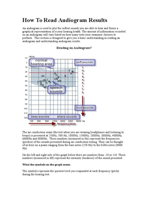 Financial institution non finance institution lawyer. How to Read Audiogram Results | Hearing | Ear