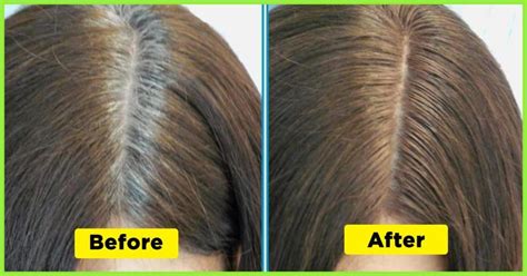 Specific cells within our hair follicles, called melanocytes, are. You Won't Believe How This Woman Uses a Cup of Potato ...