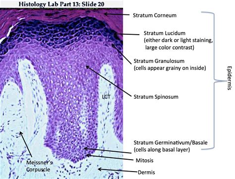 Thick Skin Labeled Histology Thick Skin Epidermis Medical Careers