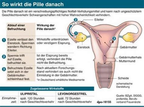 Die länge des zyklus ist von frau zu frau unterschiedlich. Erste Hilfe bei Verhütungspannen: Fragen & Antworten zur ...