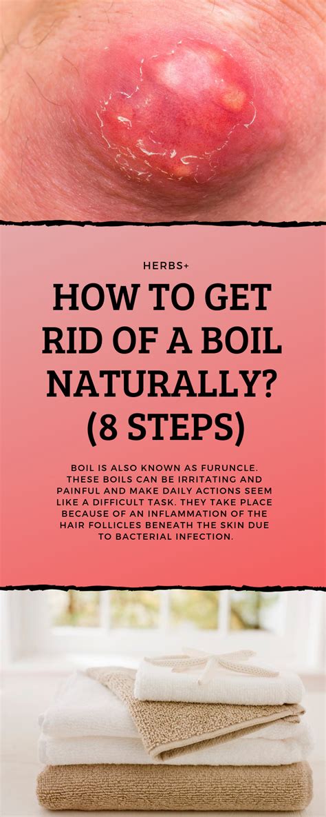 How To Get Rid Of A Boil Naturally 8 Steps Cold Home Remedies