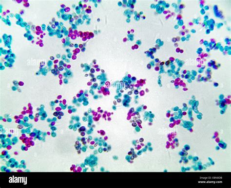 Saccharomyces Cerevisiae Yeast Cells Under Microscope Micropedia