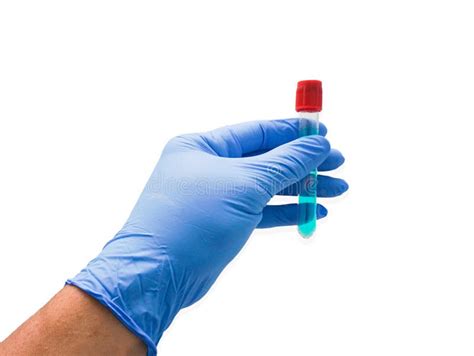 Closeup Hand Of A Lab Technician Holding Blood Tube Test On White