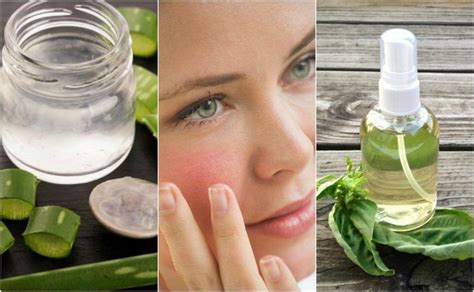 The 5 Best Home Remedies To Soothe Irritated Skin Irritated Remedies