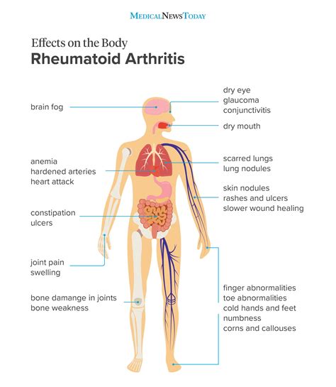 This article contains a list of organs of the human body. Effects of rheumatoid arthritis on the body