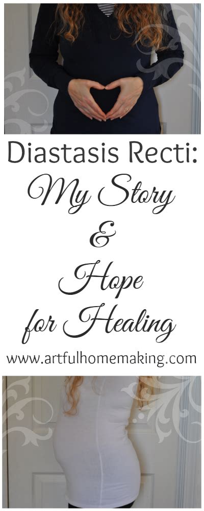 A Pregnant Woman Holding Her Stomach With The Words Diastasis Recti My
