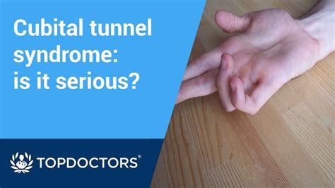 Cubital Tunnel Syndrome Is It Serious Youtube