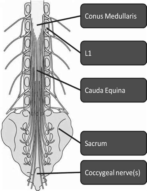 Cauda Equina And Conus Medullaris Mri