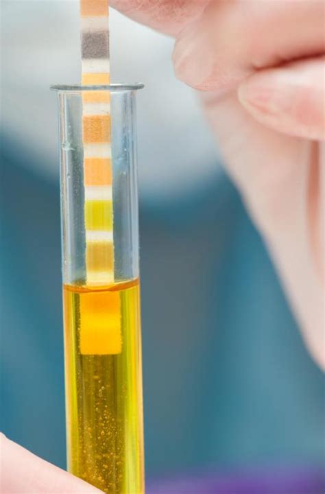 What Are The Different Types Of Urine Test Strips