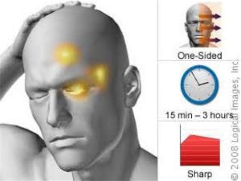 Sakit kepala jenis ini biasanya terjadi di kedua sisi kepala dan akan menjadi lebih parah ketika beraktivitas. Jenis Sakit Kepala Dan Penyebabnya