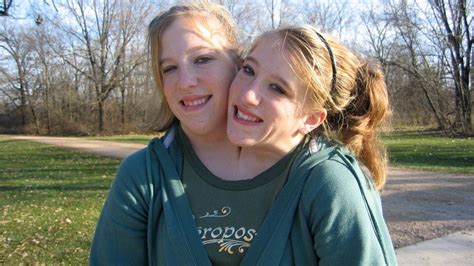Abby And Brittany Hensel Conjoined Twins Where Are They Now Nsasupply