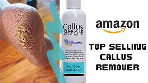 I Tested Amazons Best Selling Callus Remover Gel Dominique Denesha