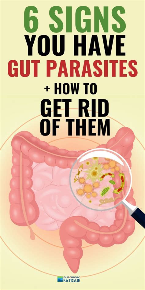 Stomach Parasites Symptoms [and How To Get Rid Of Them] Quit Chronic Fatigue Parasites