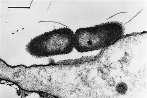 Transmission Electron Micrograph Of Burkholderia Pseudomallei Attached
