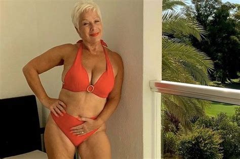 Denise Welch Celebrates 7 Years Of Weight Loss With Stunning Bikini