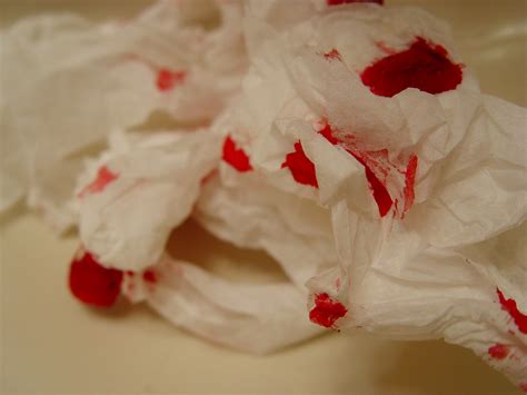 Blood On Toilet Paper After Urinating