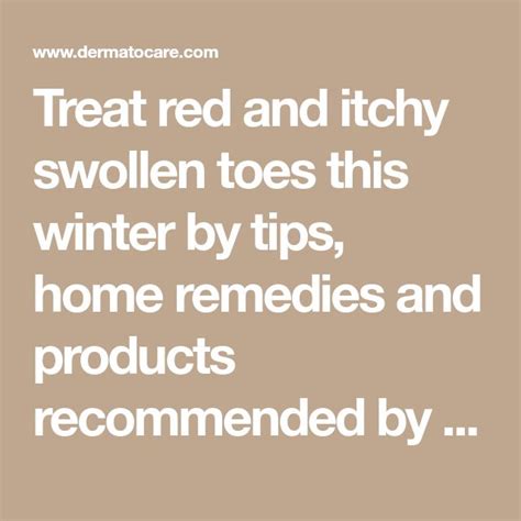 Treat Red And Itchy Swollen Toes This Winter By Tips Home Remedies And