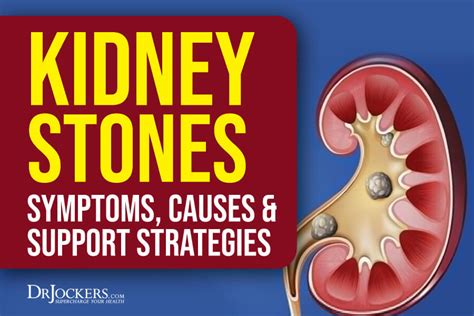 Kidney Stones Symptoms Causes And Support Strategies