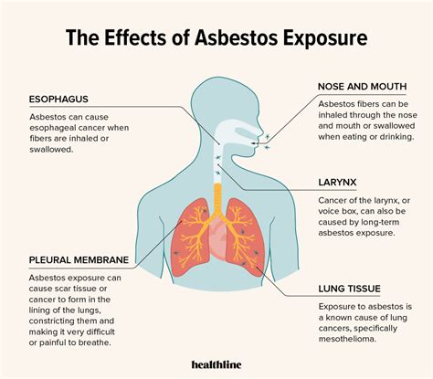 Whats The Link Between Asbestos And Lung Cancer