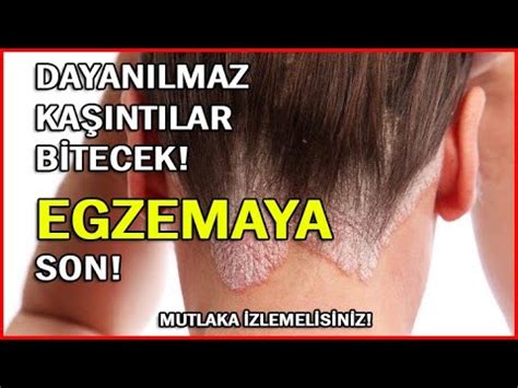 Egzema Nasıl Geçer Neden Olur Bulaşıcı Mıdır DAYANILMAZ KAŞINTILAR