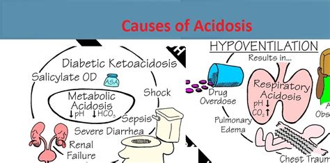 The ph level is usually low, but may be the causes of hypoventilation include conditions that disrupt the function of the respiratory center of the central nervous system; Acidosis Causes and Symptoms - Medical eStudy