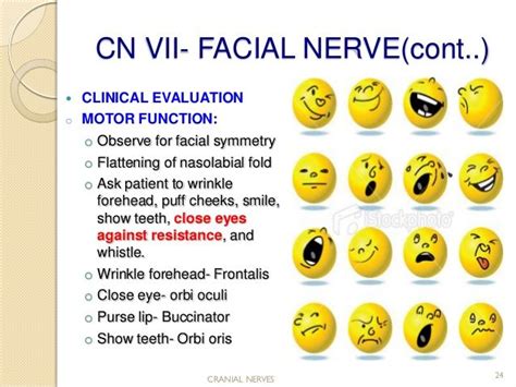Cranial Nerve Assessmentsimple And Easy To Perform For Medics And P