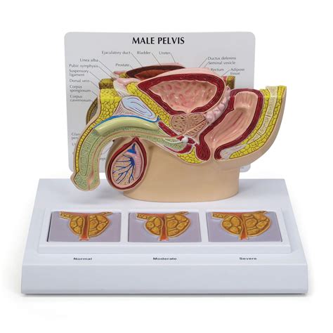 Buy Male Pelvis Model W Prostate Cross Sections Human Body Anatomy Replica Of Male Pelvis W