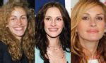 Julia Roberts Plastic Surgery Before And After Pictures 2024