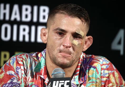Ufc Ears Video Ufc Fighters Talk About The Positives And Negatives Of