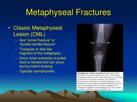 PPT - Diagnostic Evaluation in Child Abuse PowerPoint ...