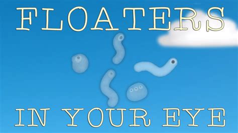 A Ted Ed Animation Explaining The Nature Of Those Floating Things That