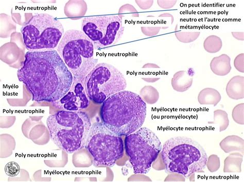 La moelle osseuse normale produit des globules rouges (érythrocytes). Confrontations ABP