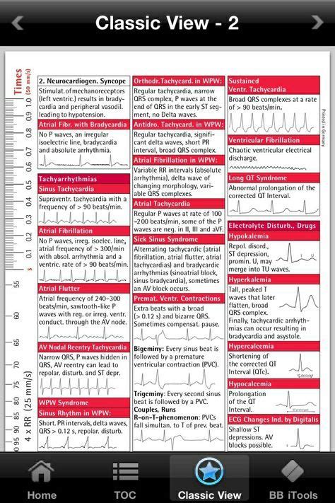 EKG Cheat Sheet Ekg Interpretation Ekg Interpretation Cheat Sheets Nurse