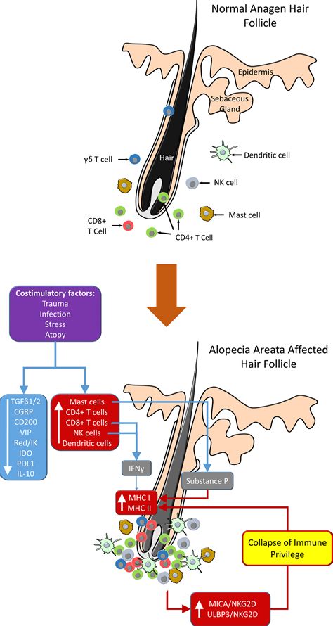 Hair Follicle Immune Privilege And Its Collapse In Alopecia Areata