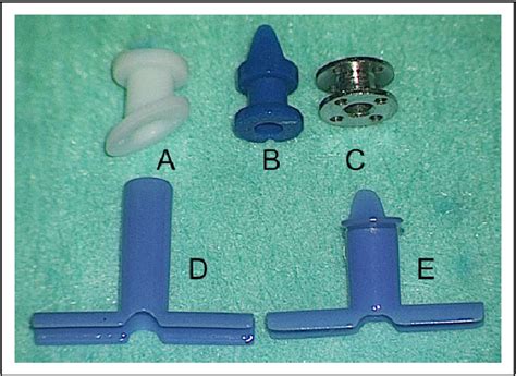 Figure 3 From Tympanostomy Tubes—a Visual Guide For The Young