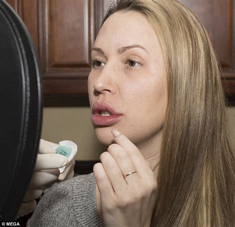 Melissa Meeks Gets Lip Fillers And Botox Daily Mail Online