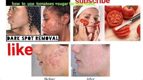 How To Use Tomatoes Sugar For Face Mask Youtube