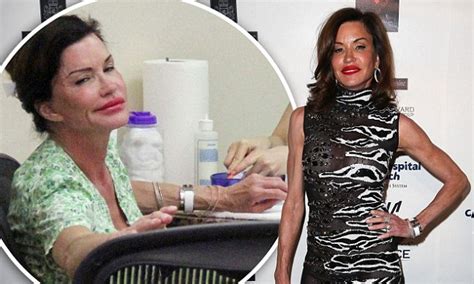 Janice Dickinsons Plastic Surgery Bills Wiped Out As California Court Discharges Debts