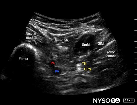 Ultrasound Anatomy Nysora E Learning System
