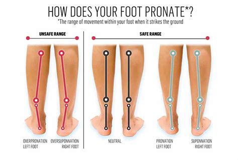 Correcting Foot Pronation Collapsing Arches With Corrective Exercise