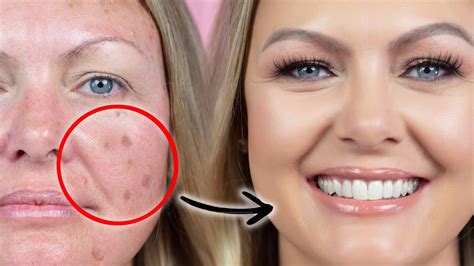 How To Apply Makeup To Er Brown Spots On Face Tutorial Pics